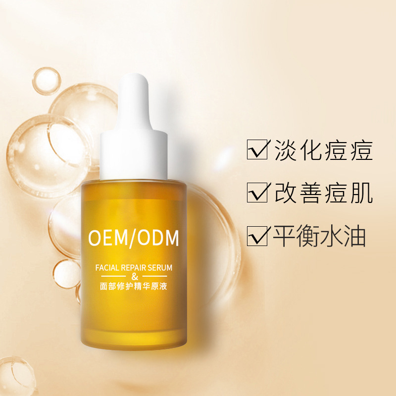 娄底市_祛痘精华原液OEM